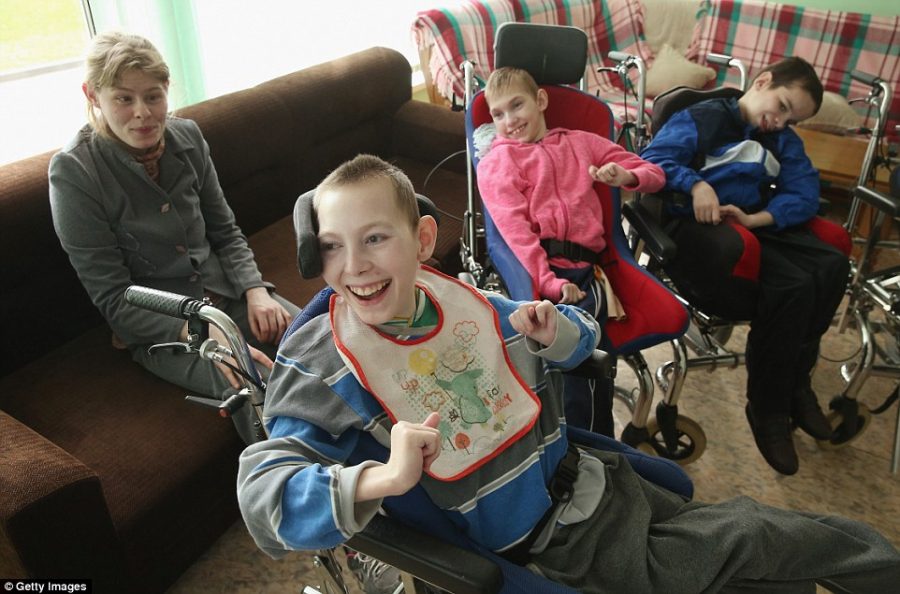 Pictured are children living with congenital birth defects, directly linked to the presence of hazardous levels of Strontium-90 in Chernobyl-contanimnated counties. 